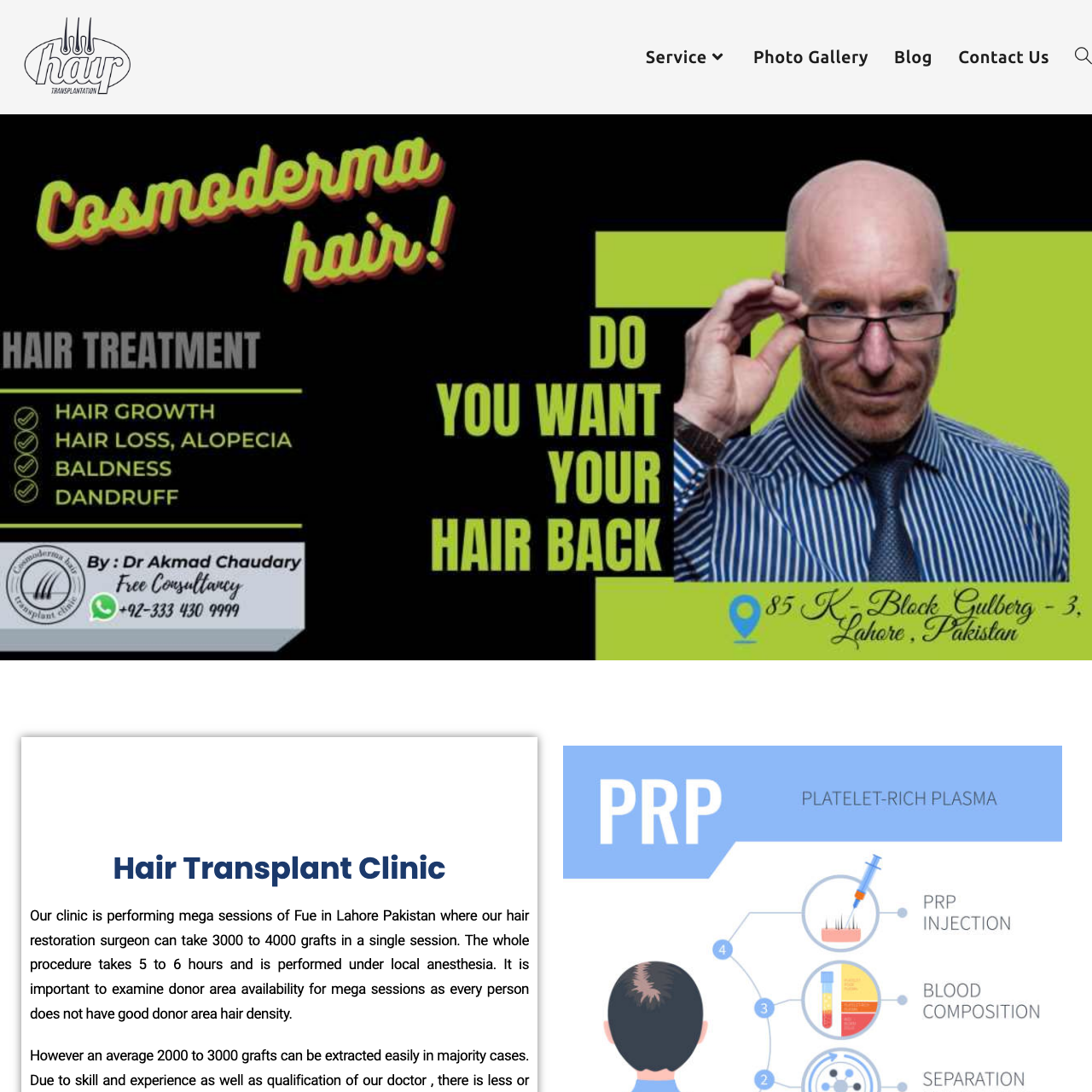 Hair Transplant clinic | Lahore